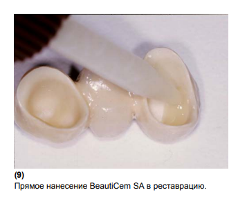 BeautiCem SA Auto-mixing, цемент самопротравливающий, самоадгезивный двойного отверждения (Ivory) SHOFU,Япония